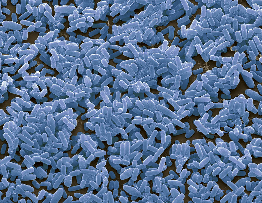 http://goodroot.ru/image/catalog/content/bacillus-subtilis-bacteria.jpg